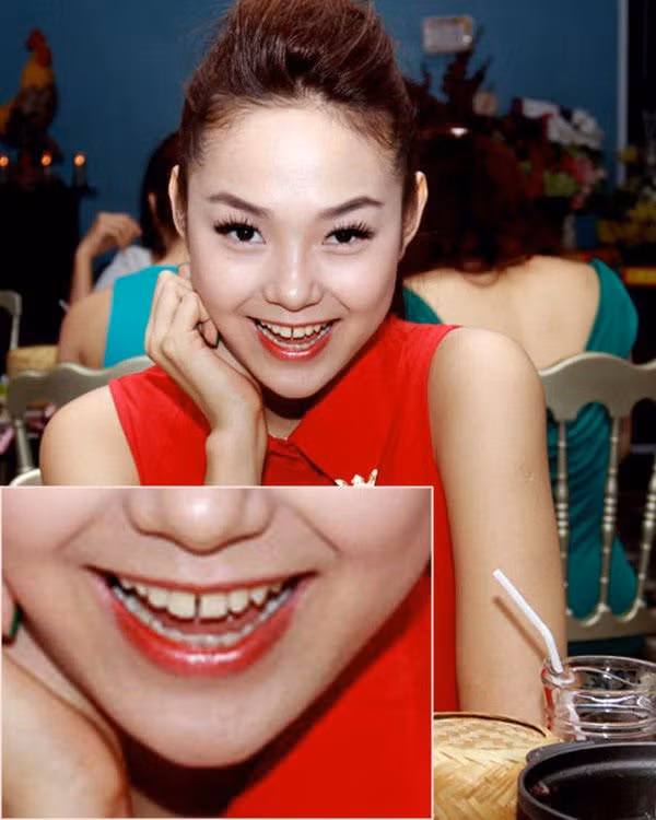 Nhung sao nu xinh dep, nhung co khuyet diem kho khac phuc-Hinh-3