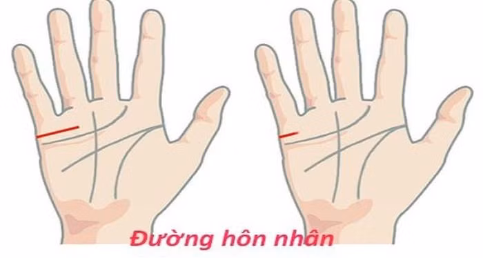 Đường chỉ tay hôn nhân ngắn. Đường chỉ tay hôn nhân là đường nằm ngay sát mép bàn tay, dưới ngón út. Đường chỉ tay hôn nhân nếu ngắn hơn bình thường thì có nghĩa là người đó không giao du với những người không có giá trị sử dụng.