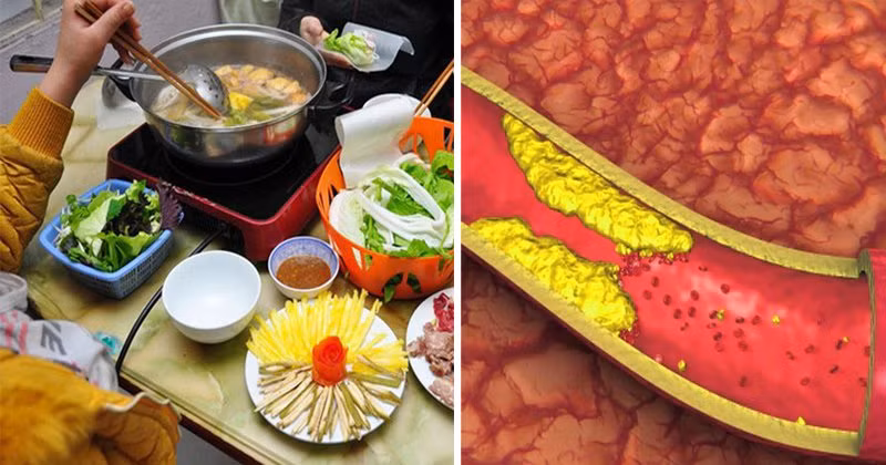3 loại thực phẩm ăn nhiều khiến mỡ máu tăng không giảm 3 loai thuc pham an nhieu khien mo mau tang khong giam
