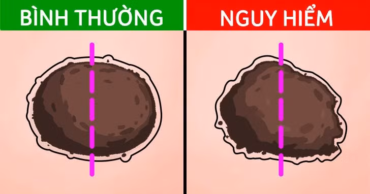 Not ruoi moc o 4 bo phan nay can de y ky-Hinh-2