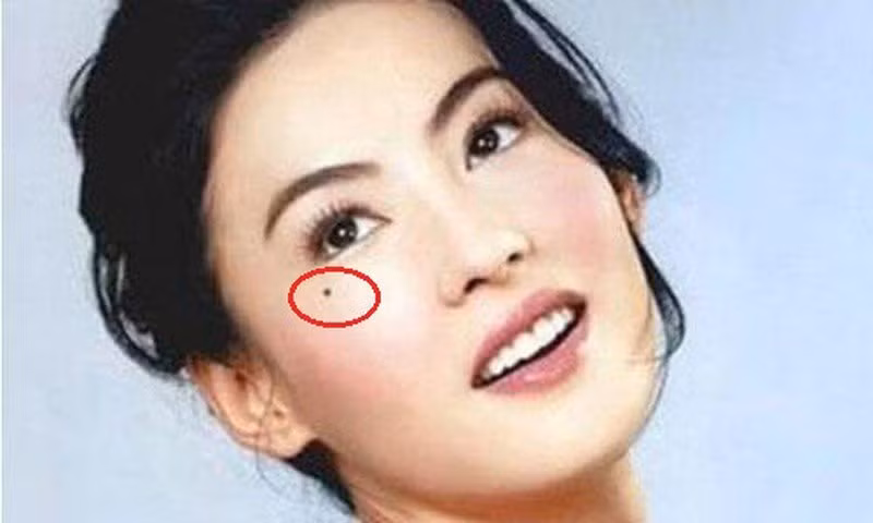 3 nốt ruồi cực phẩm tượng trưng Tài- Lộc-Phát, chỉ 1/3 phúc lộc đầy 3 not ruoi cuc pham tuong trung Tai- Loc-Phat, chi 1/3 phuc loc day