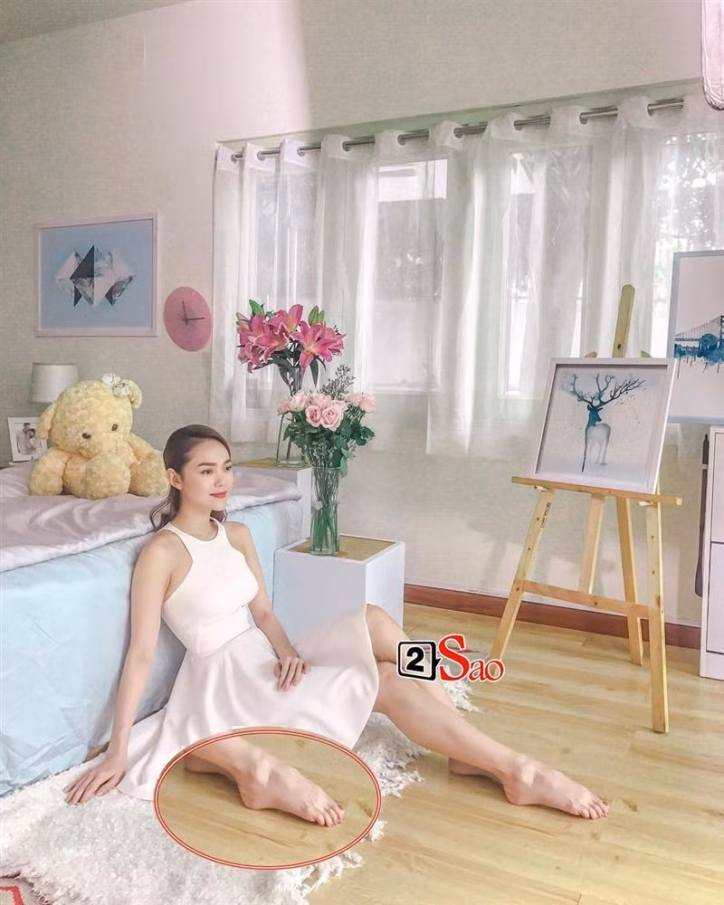 Thậm chí với những bức ảnh đã được chỉnh sửa qua, Minh Hằng cũng không che giấu nổi khuyết điểm này.