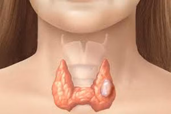 6. Kiểm tra hoóc-môn kích thích tuyến giáp. Xét nghiệm máu để kiểm tra những vấn đề ở tuyến giáp như cường giáp hoặc nhược giáp. Loại kiểm tra này nên thực hiện từ 19 tới 49 tuổi ở những phụ nữ có tiền sử gia đình mắc bệnh. Với phụ nữ trên 40, kiểm tra cứ 5 năm một lần.