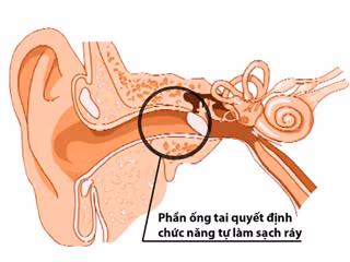 Ống tai có khả năng tự làm sạch.