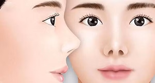 br/> Mũi hếch, tai đón gió: Là người có tính hào phóng, tiêu xài quá độ, dùng tiền vào những việc không đáng có. Đối với họ, có bao nhiêu tiền trong tay cũng hết. 