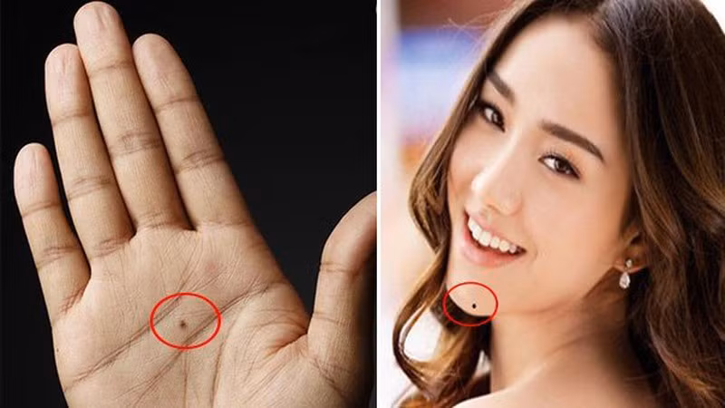 5 nốt ruồi ẩn chứa tài lộc, ai sở hữu sướng như "bắt được vàng" 5 not ruoi an chua tai loc, ai so huu suong nhu