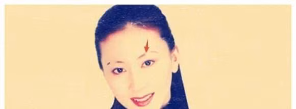 9 kieu long may xau nhat, anh huong den tuong mao va pha tai-Hinh-5