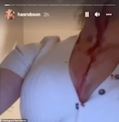 Ban gai sieu sao Manchester United dang video bi bao hanh mau me bam tim-Hinh-2