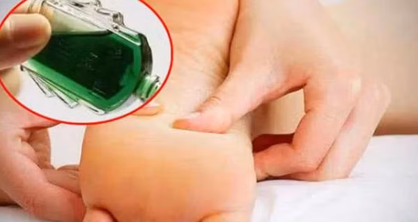 Nhỏ 1 giọt dầu gió vào bàn chân rồi đi ngủ giúp tăng sức khỏe Nho 1 giot dau gio vao ban chan roi di ngu giup tang suc khoe