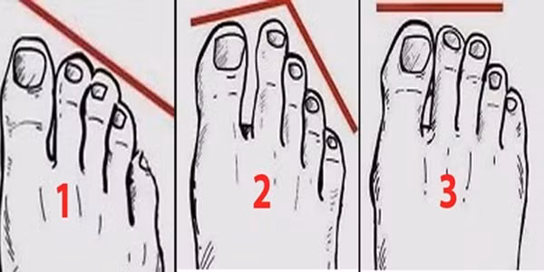 Người giàu có thường sở hữu 4 tướng bàn chân này Nguoi giau co thuong so huu 4 tuong ban chan nay