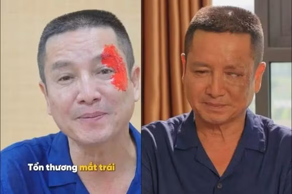 NSƯT Chí Trung hé lộ cát sê đóng phim "Độc đạo" gây bất ngờ NSUT Chi Trung he lo cat se dong phim