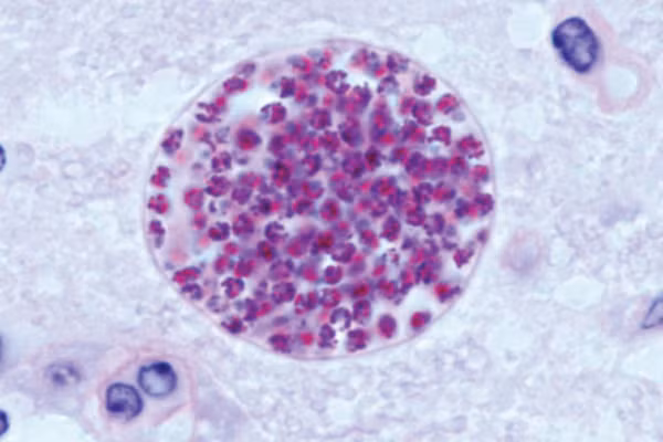 Ở loài mèo, cũng có loại ký sinh trùng thực tên là Toxoplasma gondii. Nó đi vào cơ thể người, tồn tại trong não, các tế bào cơ và tấn công vào hệ miễn dịch.