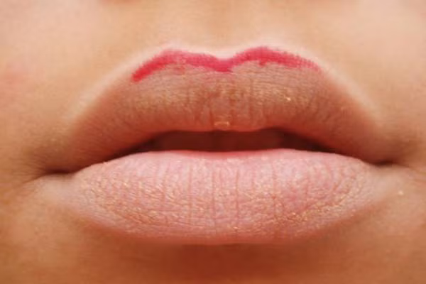 Đôi môi có đốm trắng nhạt xung quanh cho thấy thiếu máu, tuần hoàn kém. Không gì bằng một đôi môi hồng thể hiện một chế độ dinh dưỡng và sức khỏe tốt.