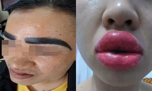 Lông mày là vị trí khá nhạy cảm và ảnh hưởng lớn đến thần thái của khuôn mặt. Chẳng hiểu vì muốn đẹp hơn nhưng rơi vào thợ "dởm" bộ lông mày trở nên vô cùng đáng sợ.