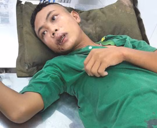 Cả trăm đối tượng buôn lậu cầm gậy vây đánh lực lượng biên phòng và công an - Hình 2 Ca tram doi tuong buon lau cam gay vay danh luc luong bien phong va cong an-Hinh-2