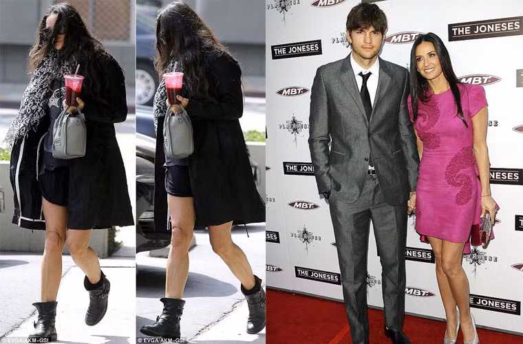 Có tin cho hay, vài năm trước, Demi Moore đã chi 8.000 USD để làm phẫu thuật căng da chân đầu gối với mong muốn trẻ hóa từng bộ phận cơ thể trước anh chồng kém cô tới 16 tuổi.