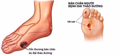 Kinh hoang can benh 