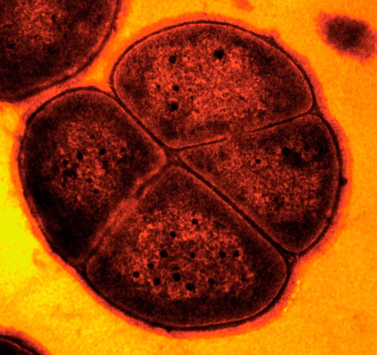 Vi khuẩn Deinococcus radiodurans có đường kính 1,62 µm, được coi là loài vi khuẩn có sức chống chịu tốt nhất từng được biết. Chúng có thể tồn tại trong thịt ngay cả sau khi đã tiếp xúc với nhiều đợt phóng xạ trong phòng thí nghiệm.
