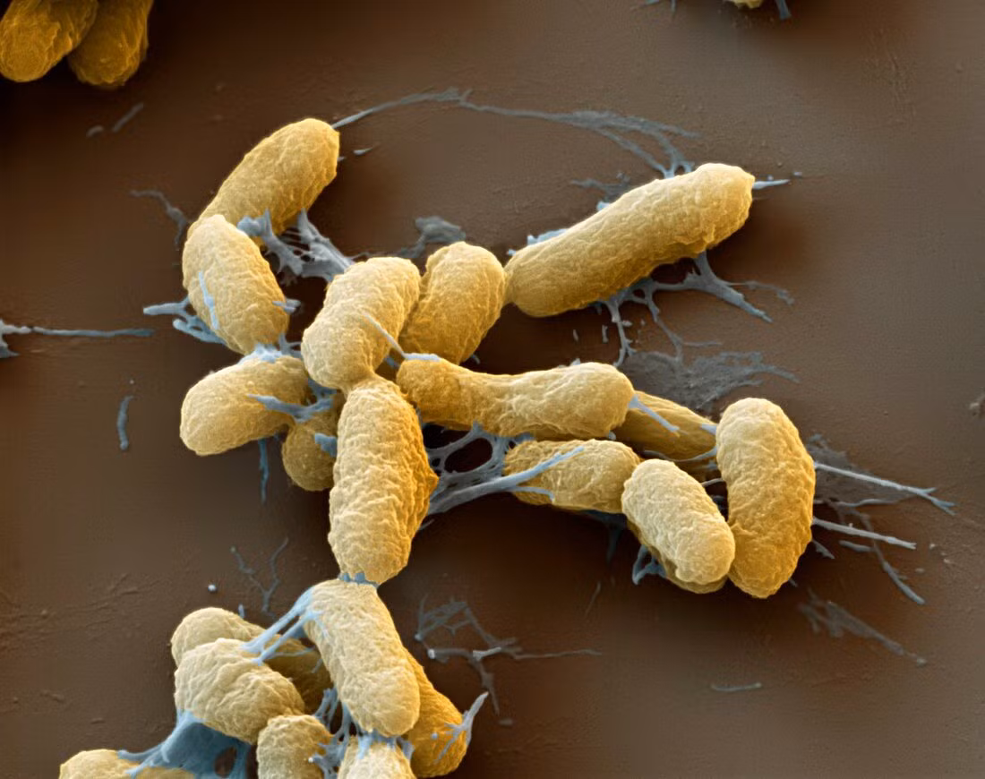 Vi khuẩn Yersinia pestis dài 1-3 µm, là tác nhân gây bệnh dịch hạch do bọ chét sống trên chuột truyền sang người. Cái tên "Yersinia" có nguồn gốc từ tên gọi bác sĩ người Pháp Alexandre Yersin, người tìm ra vi khuẩn này năm 1894.