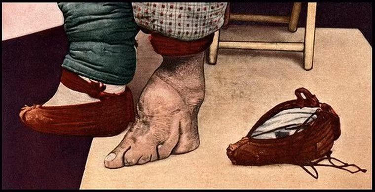 Trước khi bị “hành hạ”, bàn chân sẽ được xoa bóp nhẹ nhàng. Những dải băng bằng vải lụa hoặc đã được chuẩn bị sẵn và cũng được ngâm vào hỗn hợp dược thảo và máu động vật.