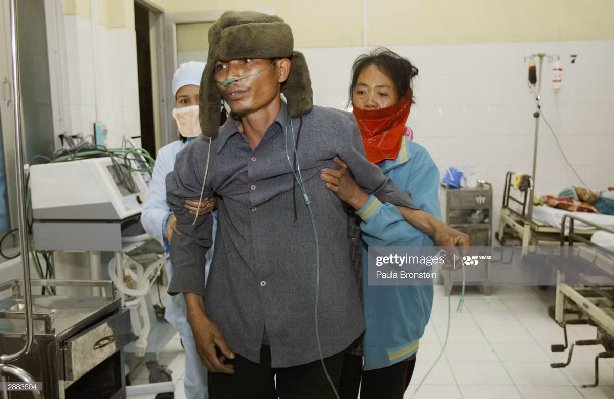 Một nam bệnh nhân nghi nhiễm cúm gia cầm được người nhà và y tá trợ giúp di chuyển trong phòng bệnh, 20/1/2004.