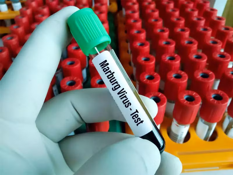 Đường lây của virus khiến 9 người chết sau khi đi dự đám tang Duong lay cua virus khien 9 nguoi chet sau khi di du dam tang