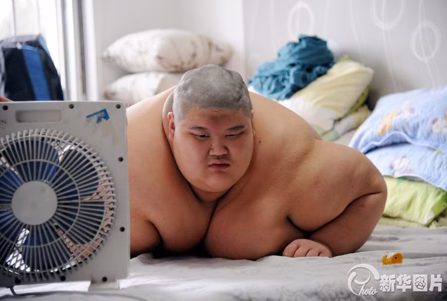 Kích thước quá khổ cản trở nghiêm trọng mọi hoạt động của anh chàng béo này, hầu như cả ngày anh ta chỉ ngồi một chỗ trên giường.