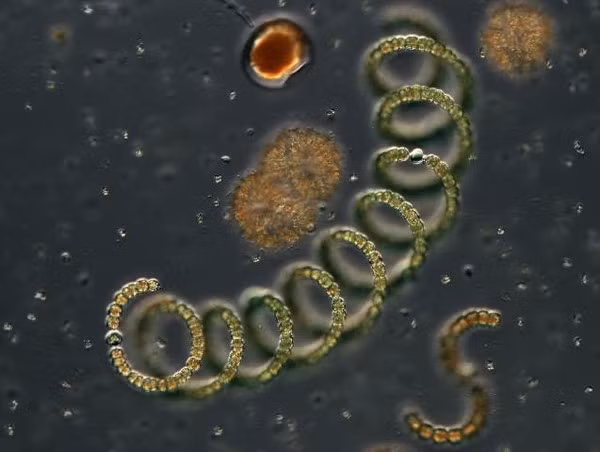 Anabaena sp hay còn gọi là vi khuẩn lam, môi trường sống của chúng hầu hết là các hồ nước ngọt lớn trên thế giới, đặc biệt là châu Úc, châu Âu, châu Á...Loại vi khuẩn này giống như một loại chất độc thần kinh ở thể gây ngừng hô hấp, may mắn thay, chúng ta có thể dễ dàng loại bỏ nó khỏi nước uồng bằng phương pháp lọc.