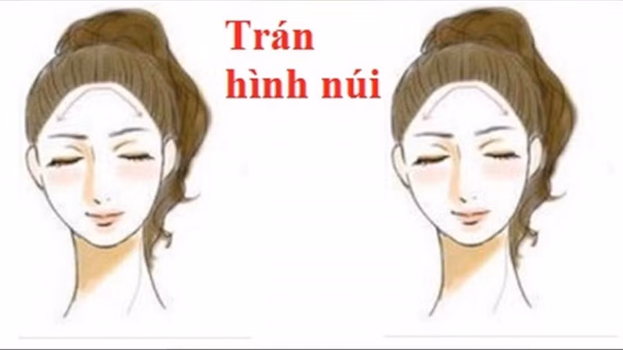 5 tướng trán của người sớm muộn cũng giàu, có căn làm sếp - Hình 2 5 tuong tran cua nguoi som muon cung giau, co can lam sep-Hinh-2