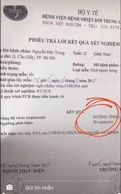 Xuất hiện phiếu xét nghiệm giả có kết quả dương tính virus corona Xuat hien phieu xet nghiem gia co ket qua duong tinh virus corona