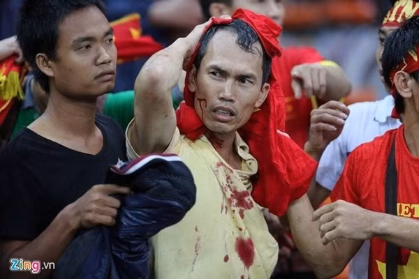Hình ảnh một CĐV Việt Nam bị đánh chảy máu trên sân Malaysia được cư dân mạng lan truyền với sự bức xúc, phẫn nộ đỉnh điểm. Liên đoàn bóng đá Việt Nam VFF cũng đã khiếu nại với Liên đoàn bóng đá Đông Nam Á về sự việc trên và mong muốn có được một lời phán xét chính xác nhất.