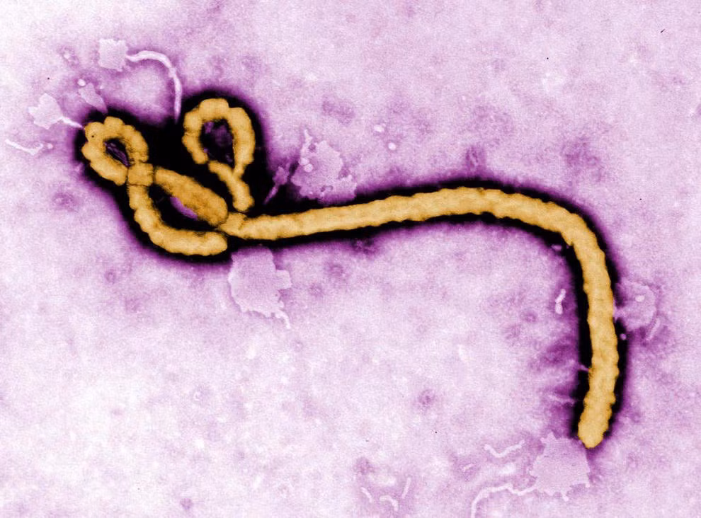 Phat hien moi ve loai virus khien 25-90% nguoi nhiem benh tu vong