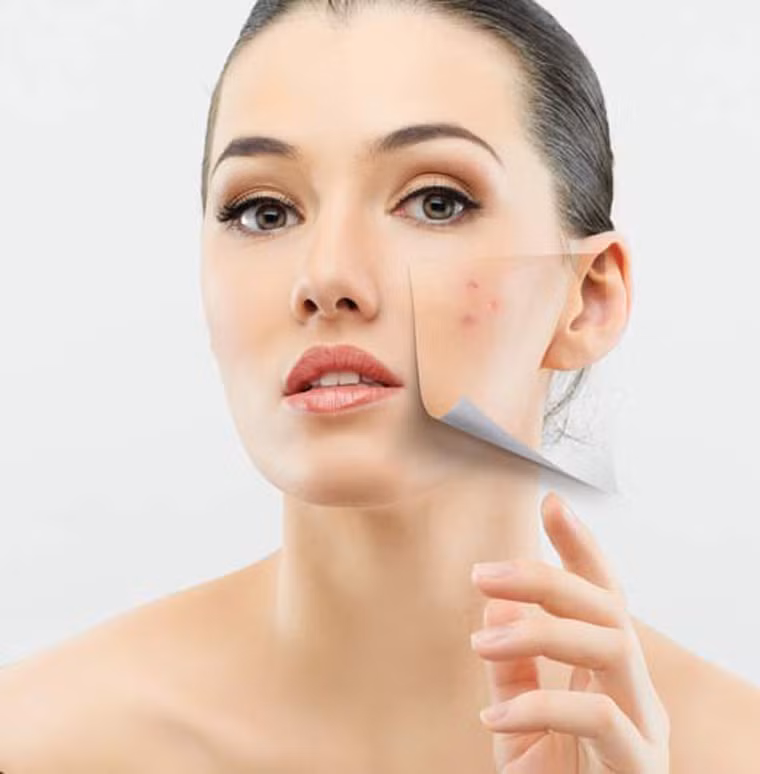 Những người có mụn, viêm da hay thương tích trên mặt, da đầu không nên nóng vội thực hiện công đoạn làm đẹp bằng cách thay đổi màu tóc. Hãy đợi đến khi cơ thể lành lặn để tránh các ảnh hưởng tiêu cực.