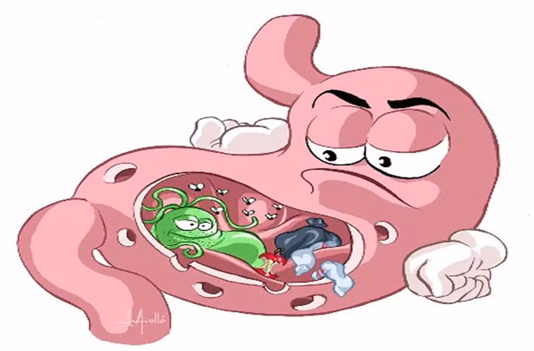 Nhiễm trùng Helicobacter pylori. Loại khuẩn này còn được gọi tắt là H. pylori và nó thường xuất hiện ở lớp niêm mạc dạ dày. Khi nhiễm H. pylori, khổ chủ dễ đối diện với chứng viêm dạ dày và loét dạ dày tá tràng. Nó cũng là nguyên nhân làm tăng nguy cơ ung thư dạ dày dù hiện chỉ một vài trường hợp mắc bệnh được ghi nhận.