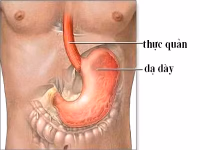 Ung thư thực quản hiện là nguyên nhân phổ biến thứ sáu gây tử vong ở Anh.