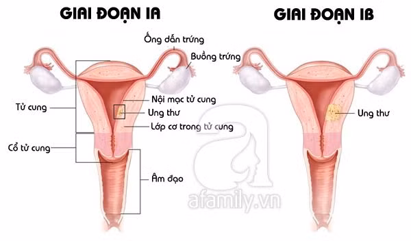 Ảnh minh họa.