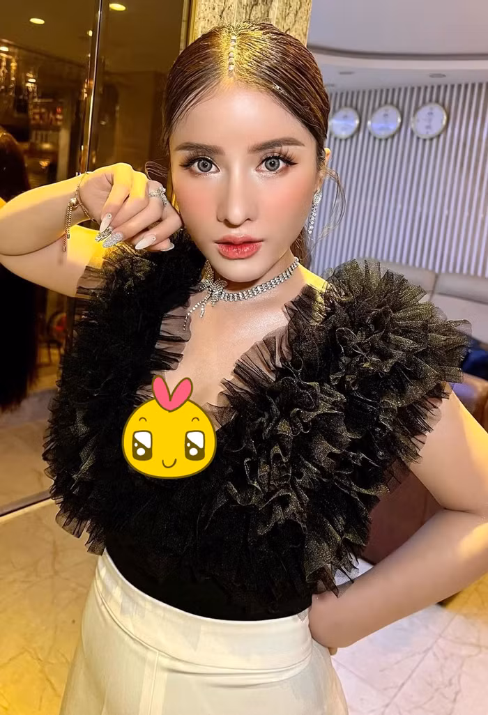 Anh thoi chua phau thuat tham my cua Ba Nhan Vlog-Hinh-3