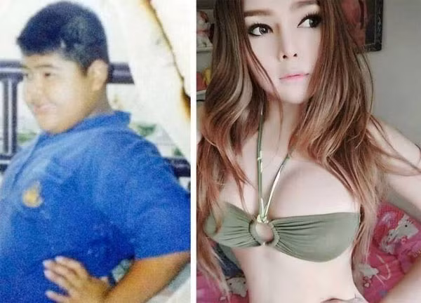 Hot girl chuyển giới Thái Lan bất ngờ gây sốt cộng đồng mạng châu Á sau khi công bố những bức ảnh trái ngược nhau hoàn toàn lúc trước và sau phẫu thuật thẩm mỹ. Theo đó, từ một cậu bé béo ú, đen đúa, cô đã trở thành con gái với nước da trắng, xinh đẹp. Thậm chí nhờ vậy, cô còn vào top 10 câu chuyện chấn động và 10 bạn trẻ gây chú ý nhất Thái Lan trong năm 2014.
