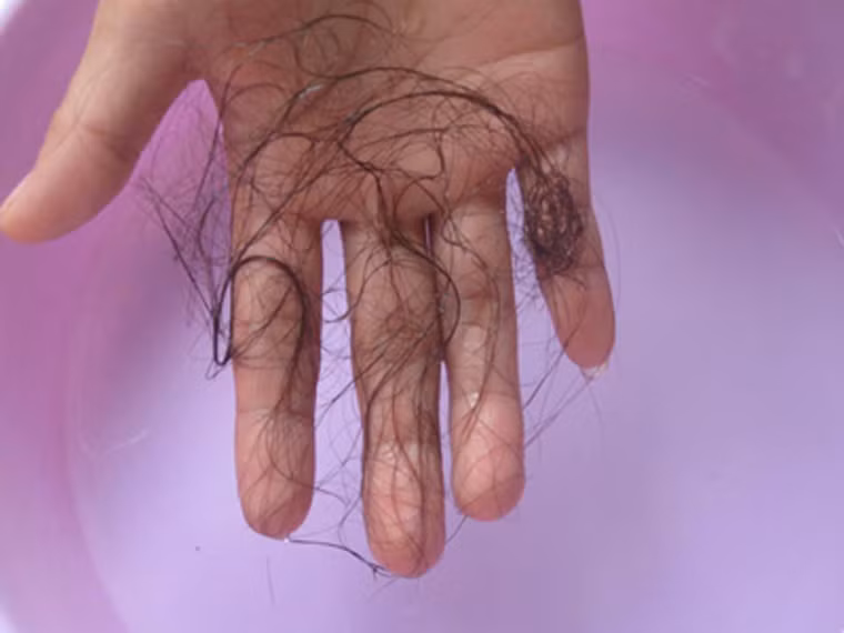 Việc buộc phải cắt bỏ ngực, sở hữu những vết sẹo nham nhở trên cơ thể hay tác dụng phụ lâu dài của quá trình điều trị cũng ảnh hưởng không nhỏ đến tâm lý, chất lượng sống của người bệnh.