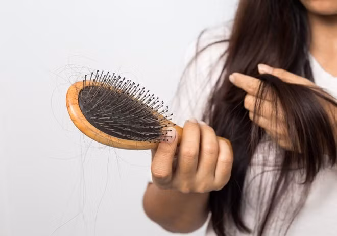 Mẹo chữa rụng tóc sau sinh cho mẹ bầu - Hình 2 Meo chua rung toc sau sinh cho me bau-Hinh-2