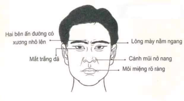 Trong mat bat hinh dong: kieu 1 tai ba xuat chung, kieu 2 bat tai-Hinh-2