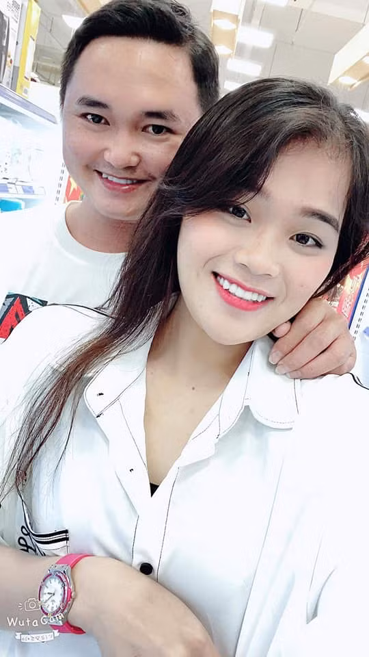 Ngoai hinh thay doi thanh sun sau hon 1 nam lam rang-Hinh-5