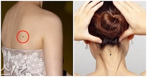 4 vị trí nốt ruồi xấu tới mấy cũng đừng xóa, để đó hưởng phúc đức 4 vi tri not ruoi xau toi may cung dung xoa, de do huong phuc duc