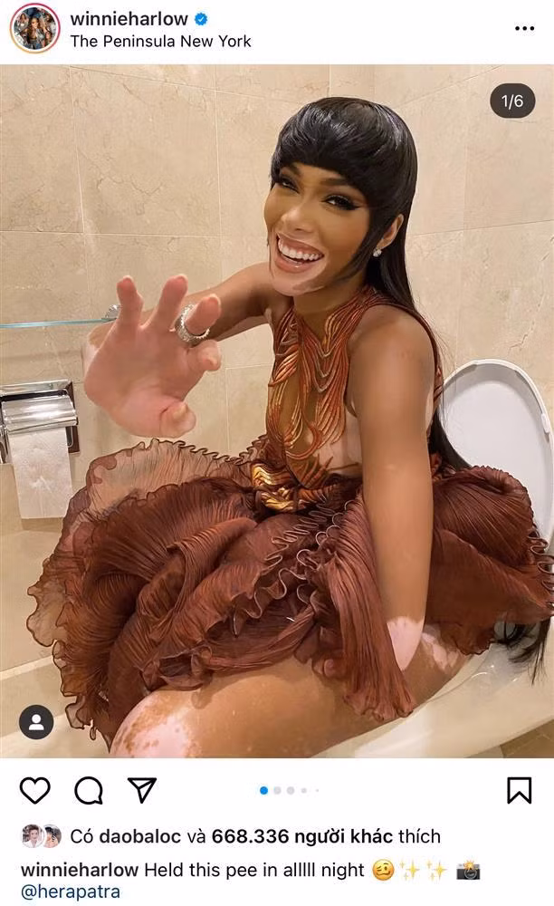 Thế nhưng không riêng Troye Sivan, khoảnh khắc có phần riêng tư và tế nhị này của Winnie Harlow - nàng mẫu bước ra từ America's Next Top Model cũng được chính chủ khoe lên với dòng trạng thái: "Nhịn cả buổi tối".