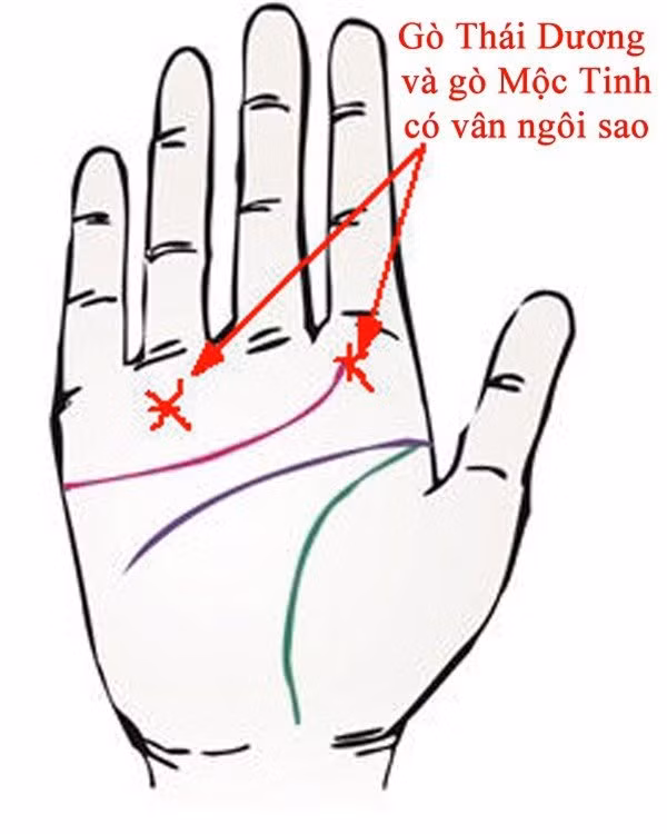  Gò Thái Dương và gò Mộc Tinh có vân ngôi sao. Gò Thái Dương nằm phía dưới ngón áp út, đại diện cho sự phú quý. Gò Thái Dương dài, đầy đặn, gồ lên và màu sắc hồng hào nhiều sức sống thì đây là người biết kiếm tiền, dễ có cơ hội phát tài.