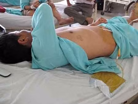 Một người đàn ông bị cắt của quý. Ảnh chỉ mang tính minh họa.