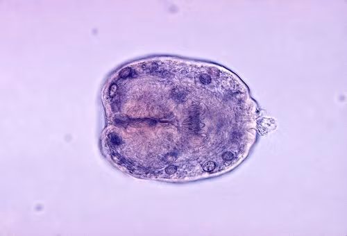 Sán dây Echinococcus granulosus dài chỉ từ 3-7mm, gây ra căn bệnh sán kim Echinococcus granulosus khó chịu. Con người bị nhiễm tình cờ qua phân chó, hoặc các thực phẩm ô nhiễm hoặc tiếp xúc trực tiếp với đất bị ô nhiễm.