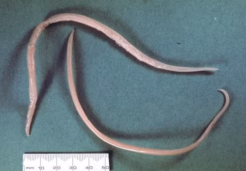 Ascaris spp là ký sinh trùng phổ biến nhất ở người. Sau khi ăn, trứng nở thành ấu trùng trong ruột, sau đó ra khỏi ruột qua máu đến phổi, di chuyển lên đường hô hấp qua cổ họng tiếp tục nuốt xuống dạ dày và trở lại ruột một lần nữa, phát triển thành giun trưởng thành.