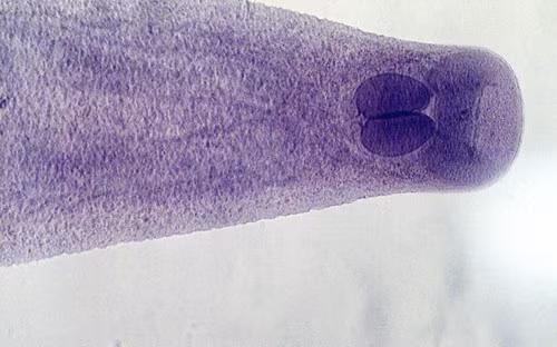 Opisthorchiidae thuộc gia đình giun dẹp, hoặc sán, nhiễm qua người khi ăn cá nước ngọt sống hoặc nấu chưa chín bị nhiễm ốc có ấu trùng.