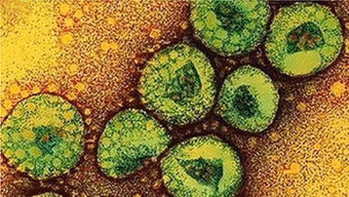 Virus “tu than” MERS-CoV nguy hiem nhu the nao?